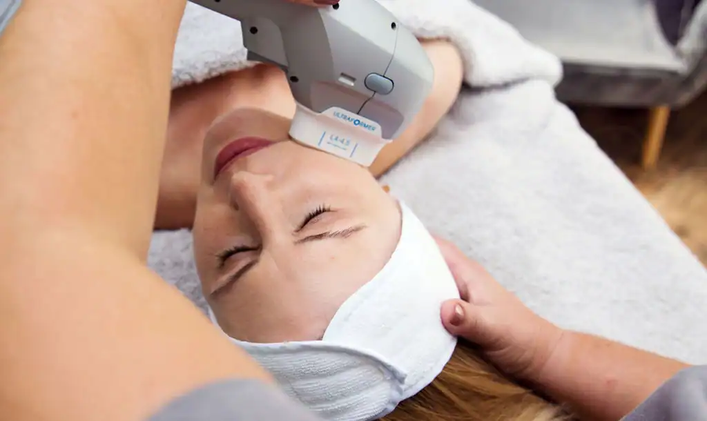 Discover the Perfect Duo: RF Microneedling and HIFU 1 Image of Morpheus8 And HIFU Wembley combined treatment